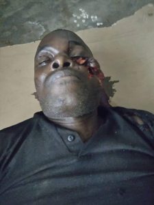 APC Chairman Gunned Down In Rivers  