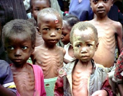 Children Cured Of Acute Malnutrition In Nasarawa State  