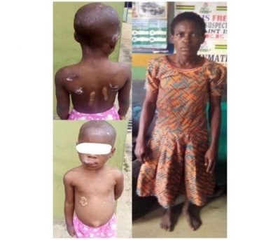 Woman Arrested For Brutalizing Niece With Hot Knife In Ogun  