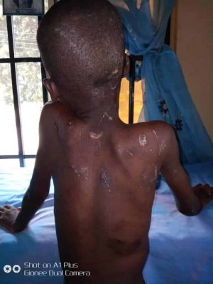 11-Years Old Girl Beaten, Fed With Cockroach And Faeces, Rescued In Awka  