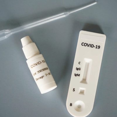Nigerian Government Announces Successful Development Of COVID-19 Test Kit  