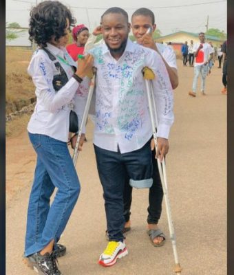 Man Who Lost His Leg From A Stray Bullet During #EndSARS Protest Graduates  