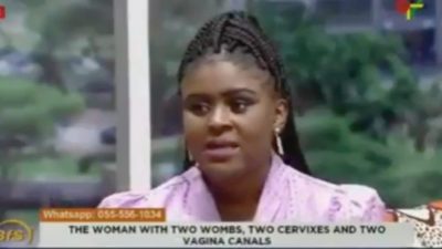 Meet Elizabeth Amoaa; The Lady With Two Wombs, Two Reproductive Organs  