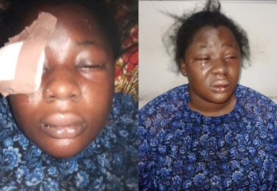 Lawyer Recounts Her Ordeal With Robbers In Lagos  
