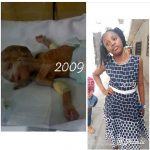 #10YearChallenge: Transformation Of Girl Born Prematurely Without Sucking Her Mother's Breast  