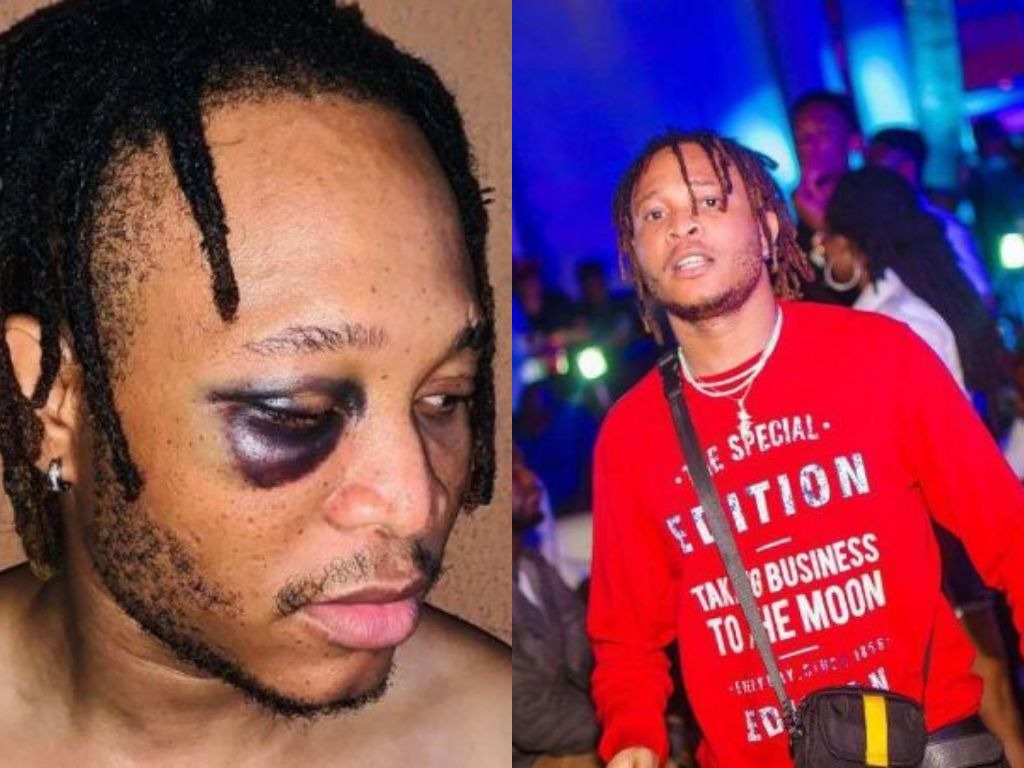 Picture Of Viktoh With 'Swollen Eye' After Police Assault Surfaces Online  