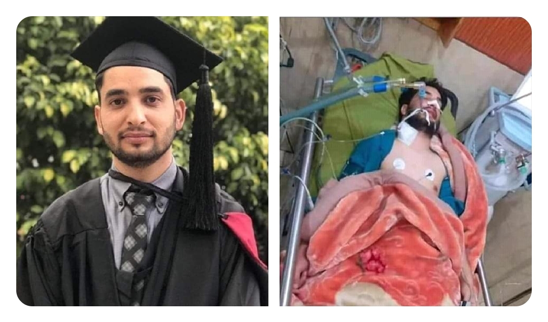 Italian Nurse With Coronavirus Commits Suicide Over Fear Of Infecting Others  