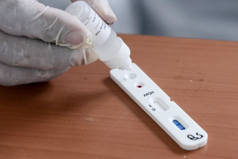 Nigerian Government Announces Successful Development Of COVID-19 Test Kit  