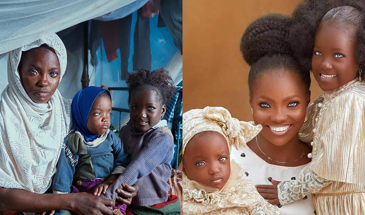 Checkout Amazing Photos Of The Woman That Was Abandoned With Her Kid By Her Husband Because Of Their Eyes Colour  