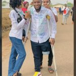 Man Who Lost His Leg From A Stray Bullet During #EndSARS Protest Graduates  