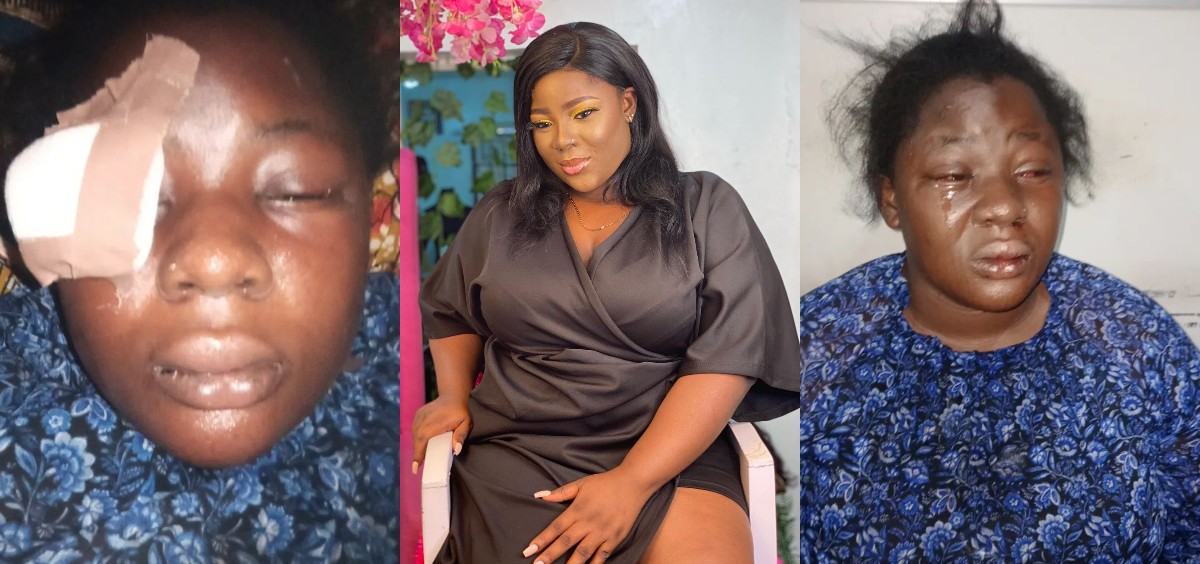 Lawyer Recounts Her Ordeal With Robbers In Lagos  