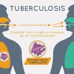 NTBLCP Warns Nigerians: Tuberculosis is not caused by witchcraft  